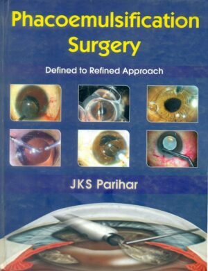 Phacoemulsification Surgery Defined To Refined Approach