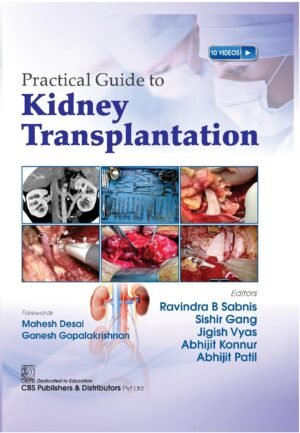 Practical Guide to Kidney Transplantation
