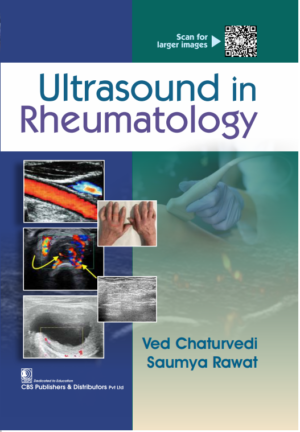 Ultrasound in Rheumatology