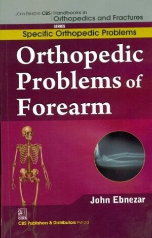Orthopedic Problems Of Forearm (Handbooks In Orthopedics And Fractures Series, Vol.45 -Specific Orthopedic Problems)