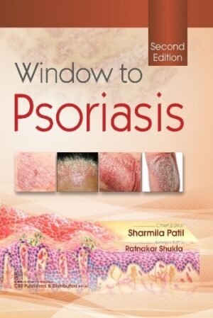 Window to Psoriasis