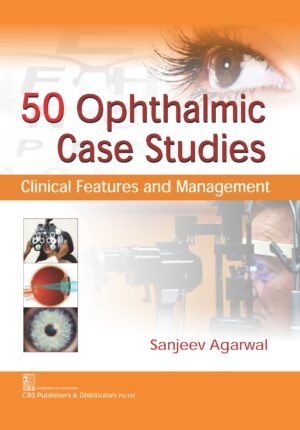 50 Ophthalmic Case Studies: Clinical Features and Management