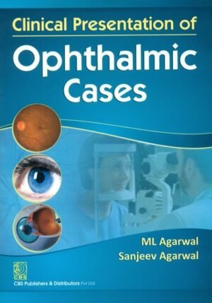 Clinical Presentation Of Opthalmic Cases (Pb2014)