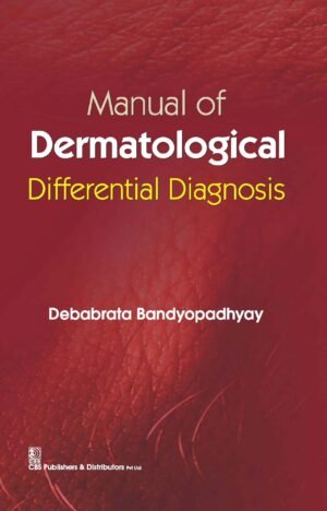Manual Of Dermatological Differential Diagnosis (Pb 2016)