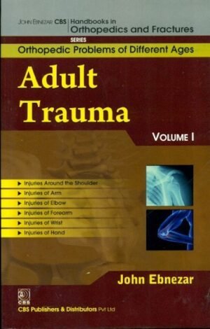 Adult Trauma Vol. 1 (Handbooks In Orthopedics And Fractures Series, Vol. 75 Orthopedic Problems Of Different Ages)