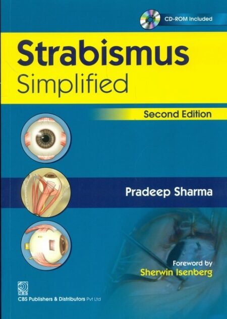 Strabismus—Simplified