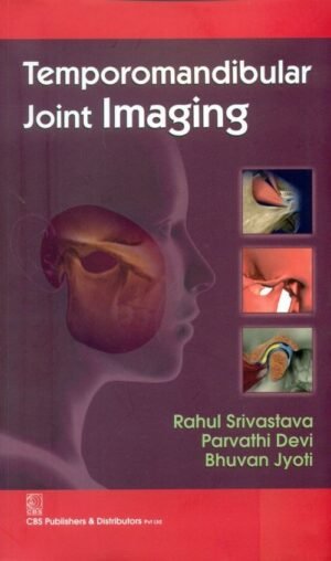 Temporomandibular Joint Imaging