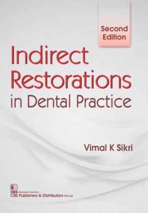 Indirect Restorations in Dental Practice, 2e