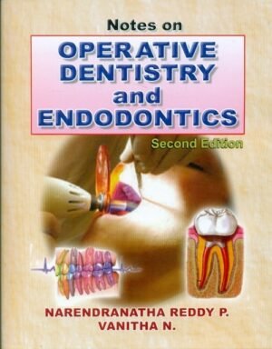 Notes On Operative Dentistry and Endodontics