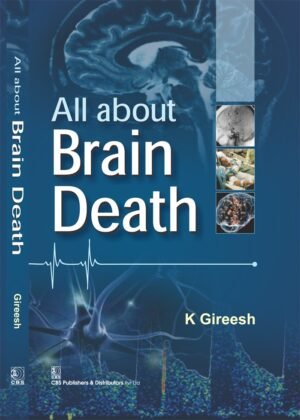 All About Brain Death