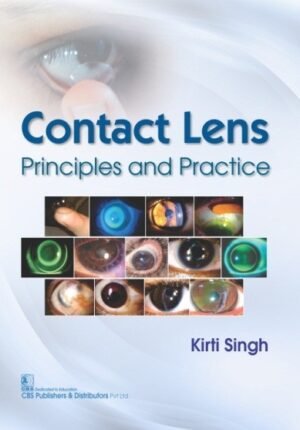 Contact Lens Principles and Practice