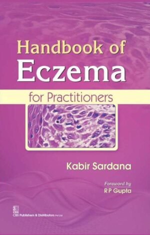 Handbook Of Eczema For Practitioners