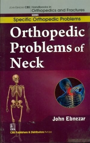 Orthopedic Problems Of Neck (Handbooks In Orthopedics And Fractures Series, Vol.39: Specific Orthopedic Problems)