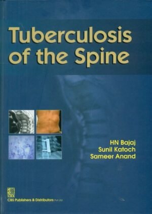 Tuberculosis of the Spine