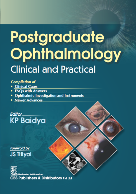 Postgraduate Ophthalmology: Clinical and Practical